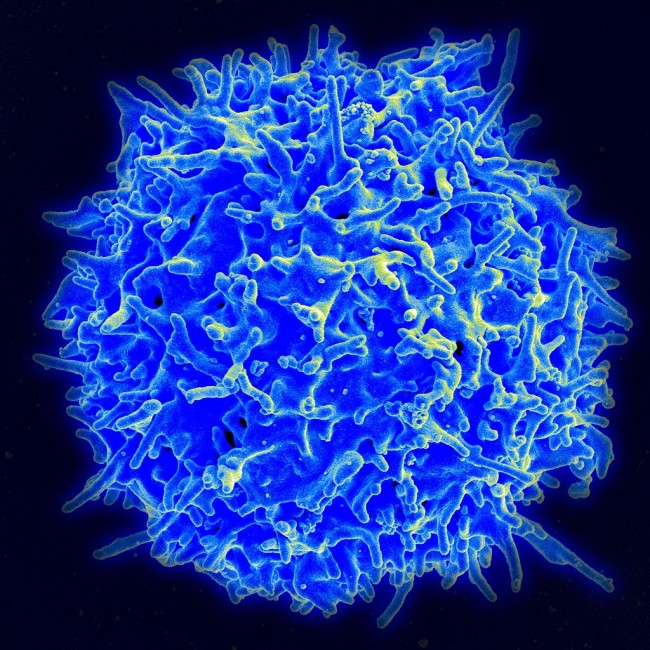 인간의 면역세포 중 하나인 T세포. 3세대 항암치료제인 면역치료제에서 중요한 역할을 한다. - 미국국립보건원 국립알레르기및감염병연구소 제공